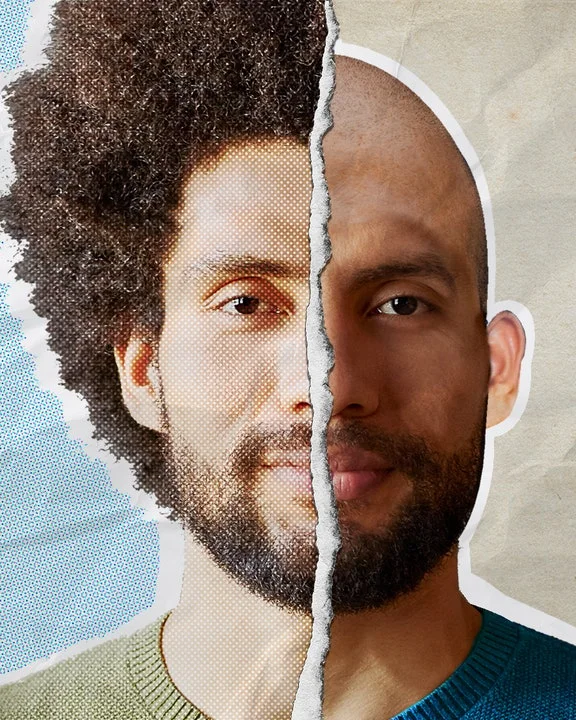 Hair Transplant Bodrum