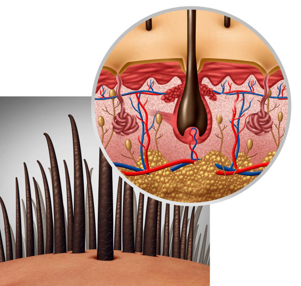 Hair Transplant Kusadasi