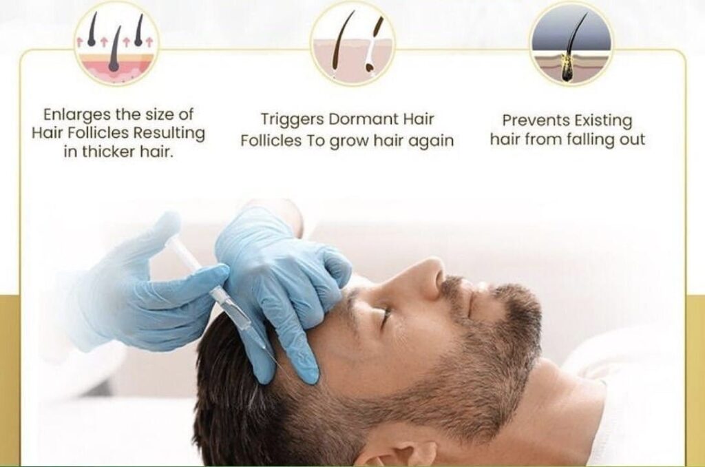 Bodrum'da PRP Tedavisi