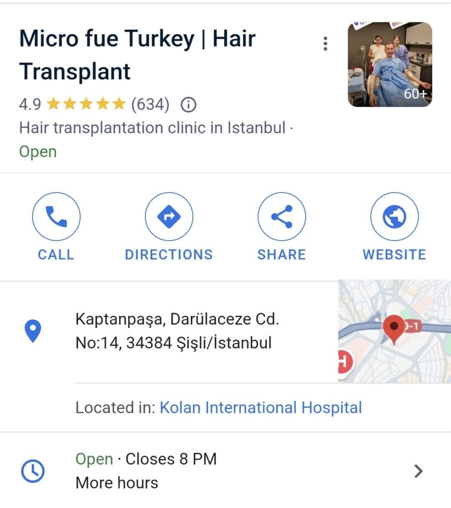 Micro Fue Turkey Reviews