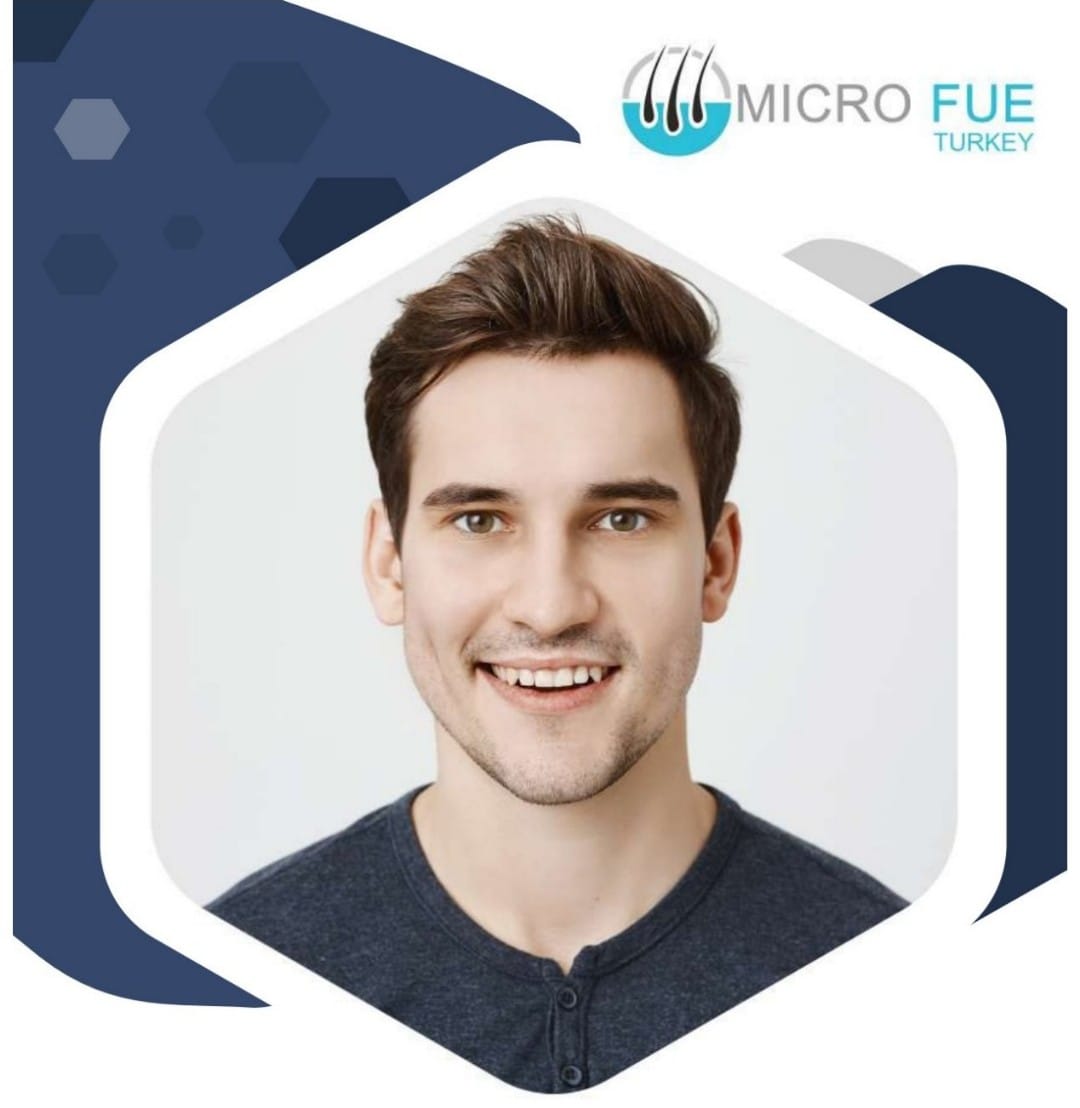 Why Is It Important to Pay a Deposit?