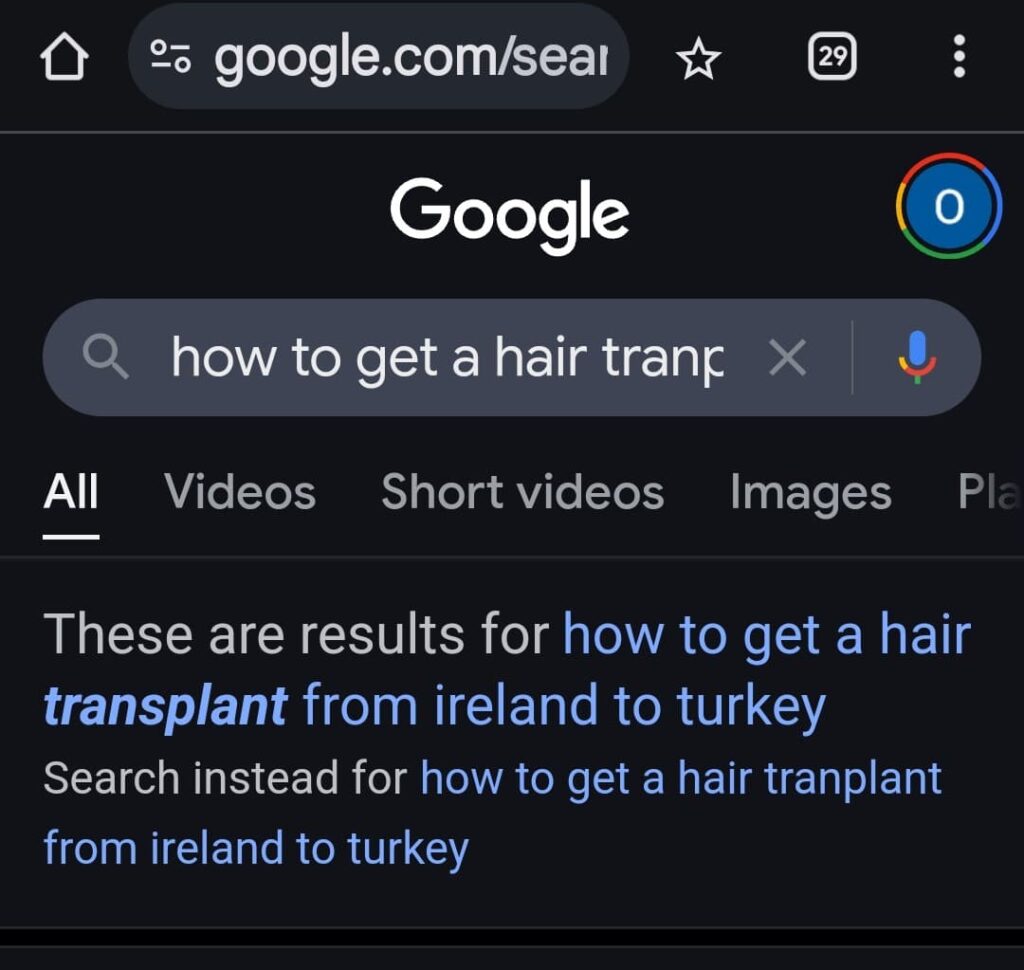 How to Get a Hair Transplant from Ireland to Turkey