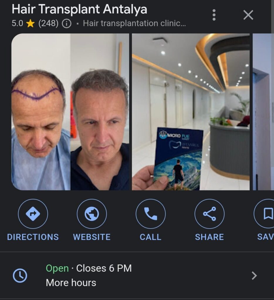 FUE, DHI, and Sapphire hair transplant services in Antalya