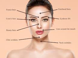 Affordable Botox in Fethiye