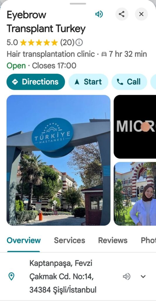 How to Go for an Eyebrow Transplant in Turkey