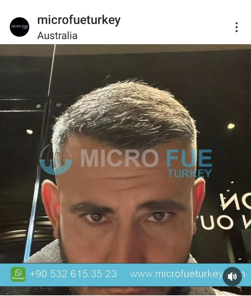 Rediscover Your Confidence