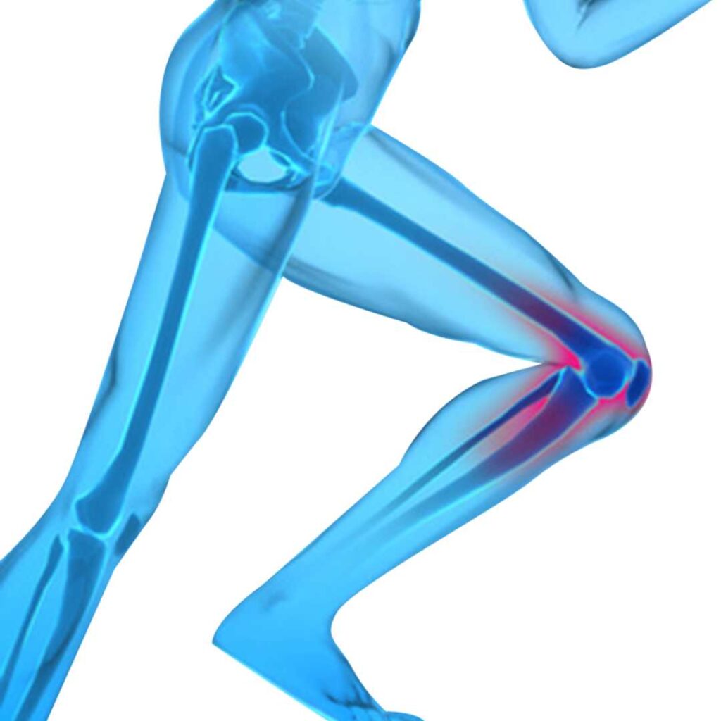 Meniscus Surgery in Turkey
