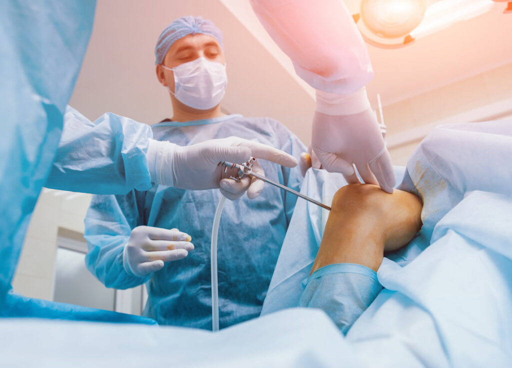 Meniscus Surgery in Turkey