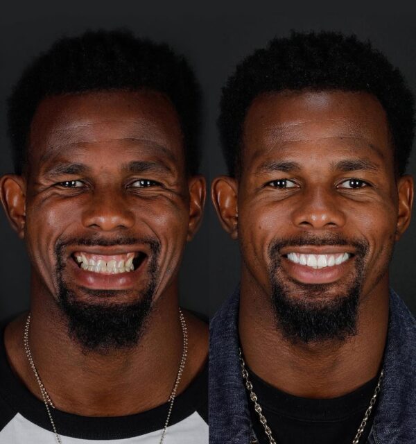 Найдите свою идеальную улыбку