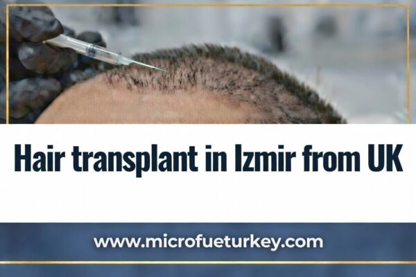 Hair transplant in Izmir from UK
