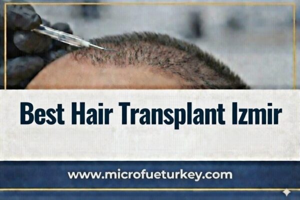 Najlepszy Przeszczep Włosów Izmir