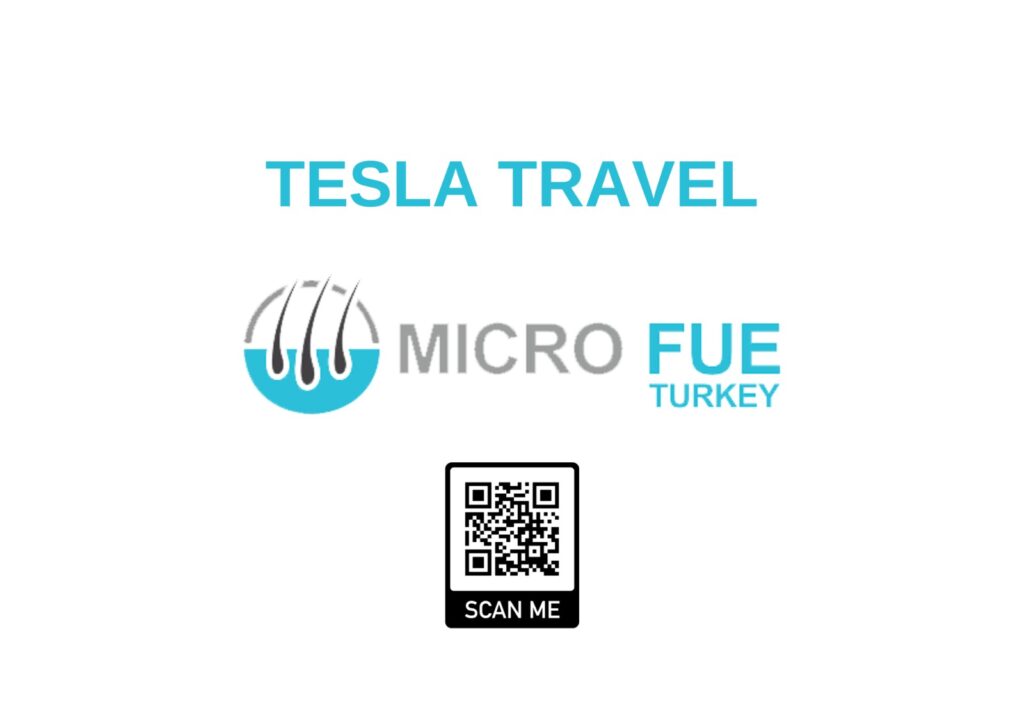 Micro FUE Turkey in London