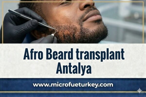 Przeszczep Brody Afro Antalya