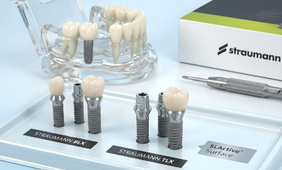 Modern dental clinic reception area in Antalya Turkey with friendly multilingual staff welcoming international patients